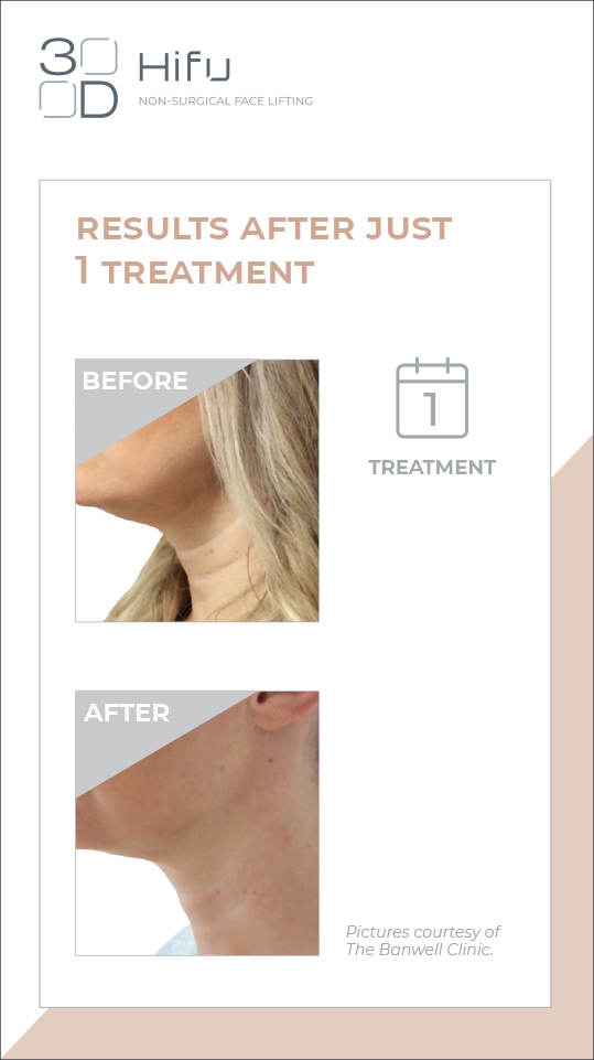 HIFU results